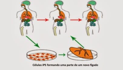 dr carlos couri celulas ips diabetes