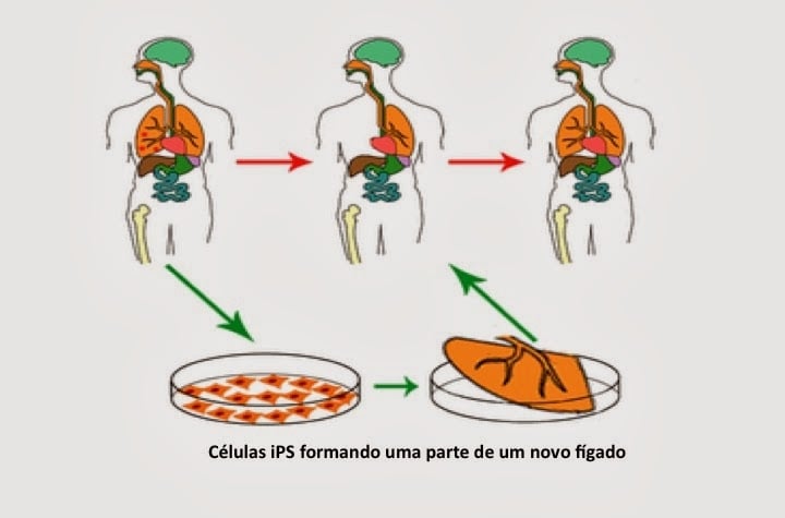 dr carlos couri celulas ips diabetes