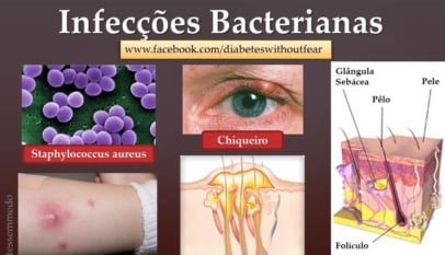 diabetes e infeccoes bacterianas