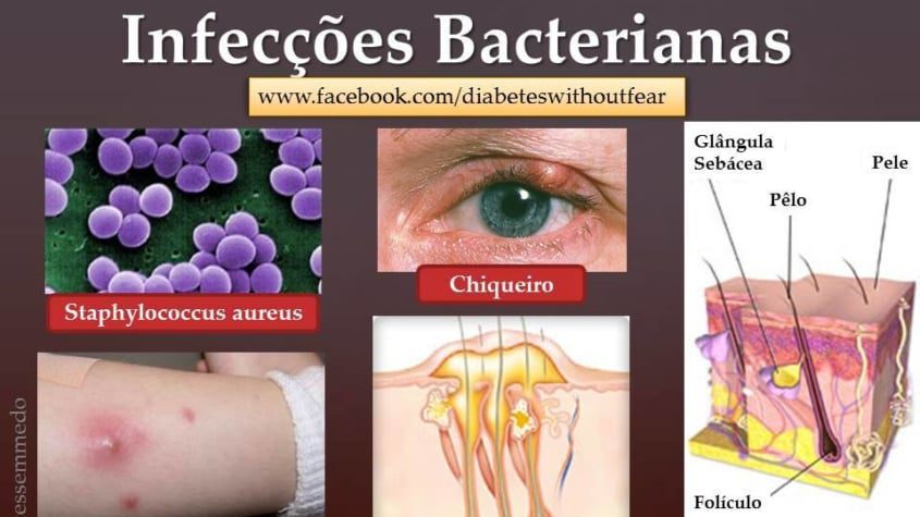 diabetes e infeccoes bacterianas