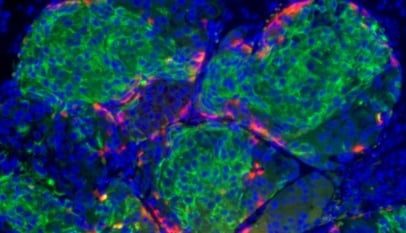 celulas beta tronco diabetes