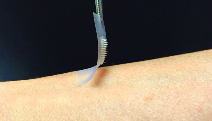 foto- diabetes - adesivo de insulina 2015